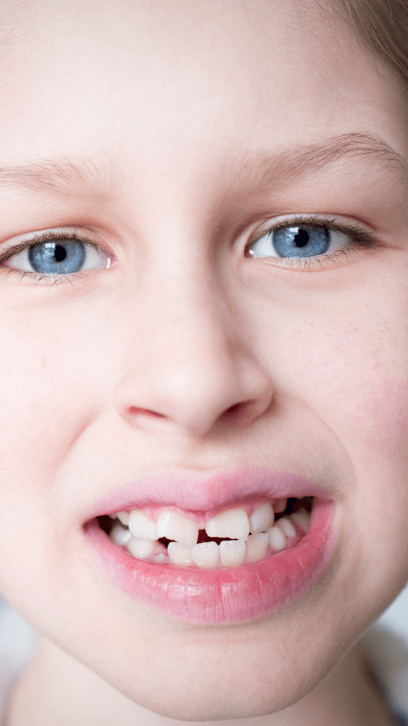 diş kopmalarında ilk yardım hikaye logosuz